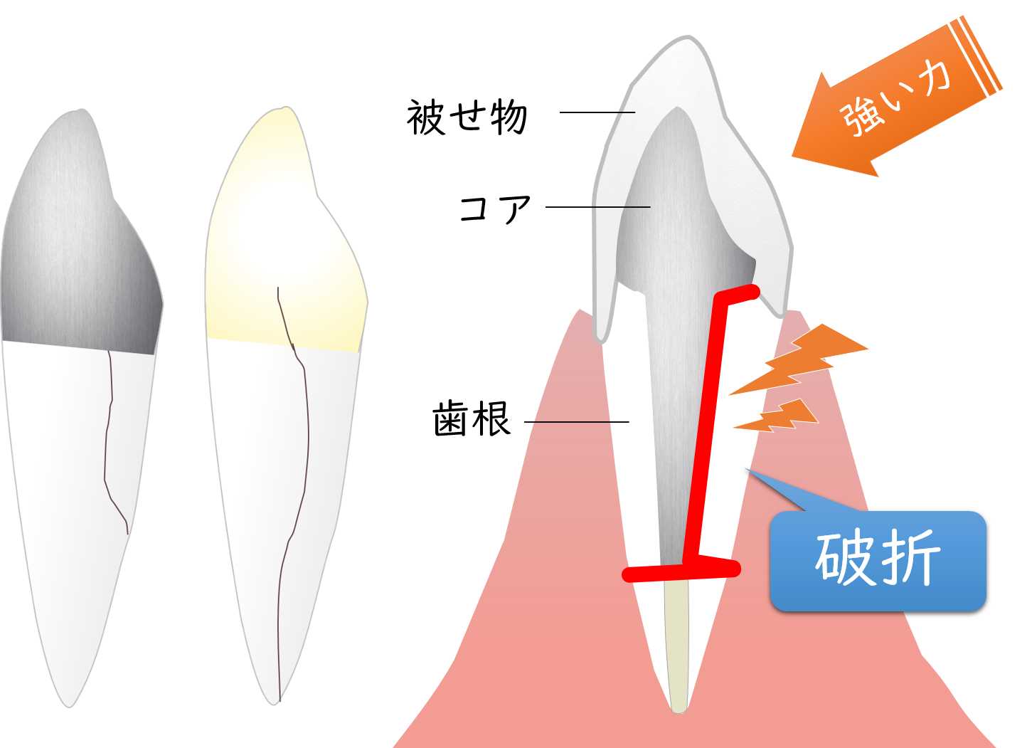 池袋の歯医者、サンシャインサイド太田歯科の歯科用ＣＴ